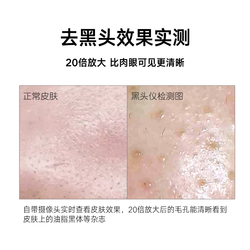 美容仪吸黑头源头厂家