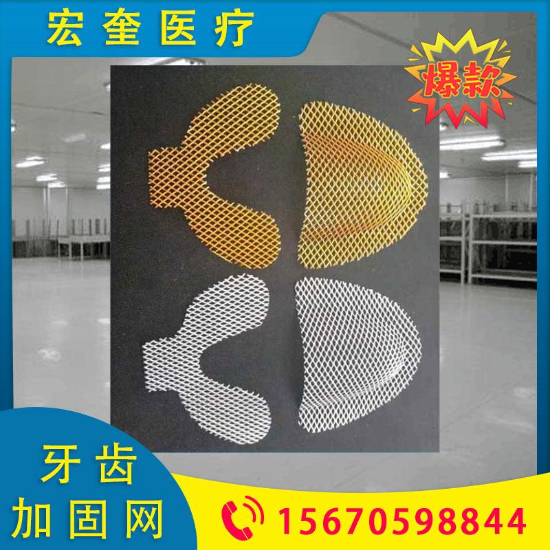 宏奎医疗 商用牙齿加固网  金属假牙加固网 义齿加固网铝制紧密加固基托坚固 金色银色两色可选牙齿加固网 胶托加固网 上颚加固网下颚加固网    义齿加固网