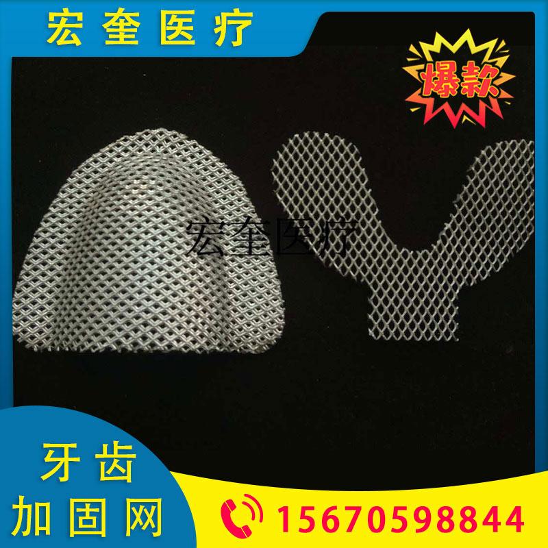 宏奎医疗 合格菱形孔牙齿加固网  矫正材料菱形加固网 牙科器械口腔齿科耗材 义齿加固网 金属假牙加固网    金色银色两色可选牙齿加固网