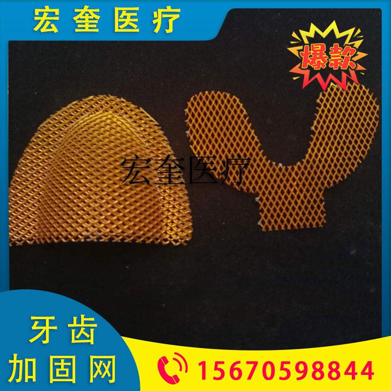 宏奎医疗 合格医用牙齿加固网  矫正材料菱形加固网 牙科器械口腔齿科耗材 义齿加固网 金属假牙加固网  金色银色两色可选牙齿加固网  上颚加固网下颚加固网