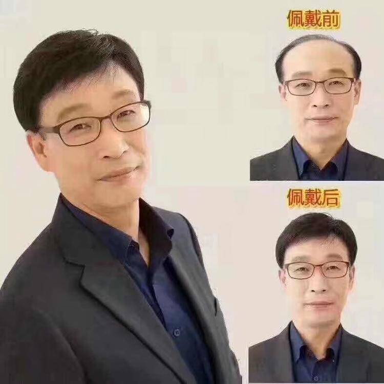 成都假发补发定制发质优良