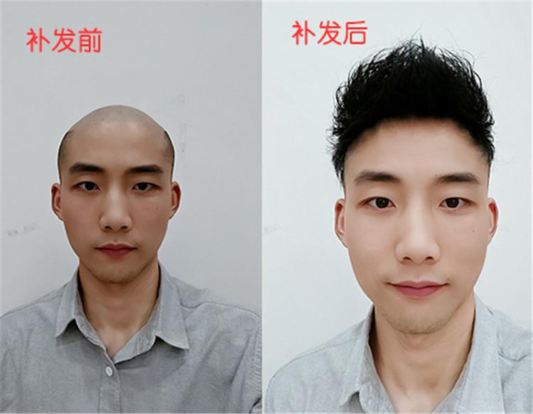 四川成都男士假发定制厂家价格优惠