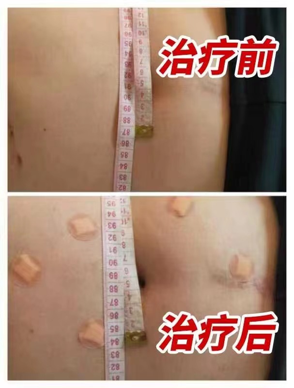 缩略图 3