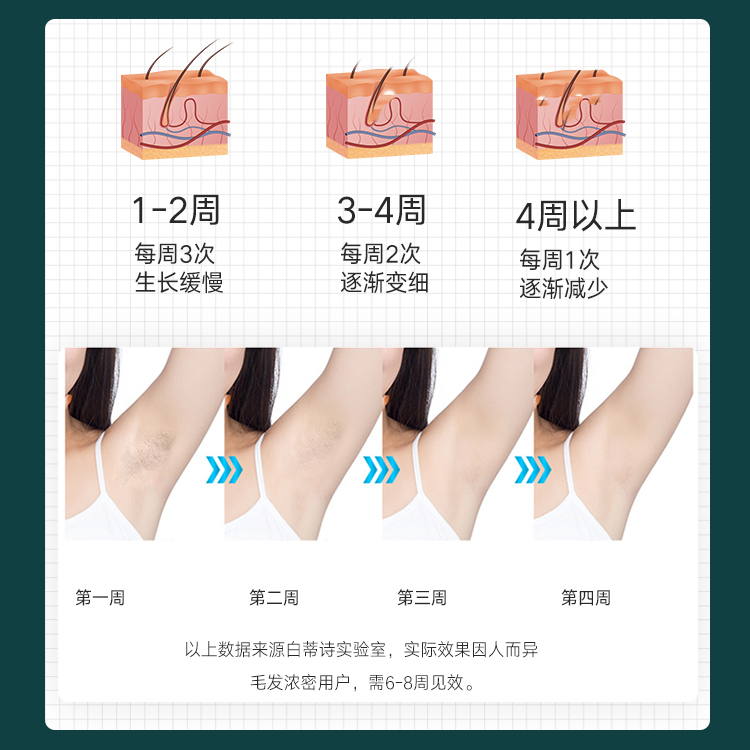 IPL脉冲家用激光脱毛仪