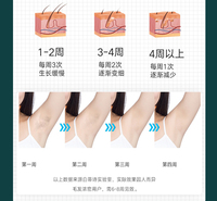 IPL脉冲家用激光脱毛仪